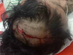 Di Pangururan Seorang Wanita Diduga Dianiaya Hingga Batok Kepala Retak Dan Pendarahan Pada Otak.