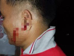 Diduga Dikeroyok di Teras Rumah, Korban Lapor ke Mapolsek Tapung Hulu 