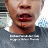 Terlapor diduga pelaku pengeroyokan buruh, dilepaskan dari Kantor Polsek kandis.