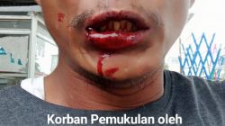 Terlapor diduga pelaku pengeroyokan buruh, dilepaskan dari Kantor Polsek kandis.